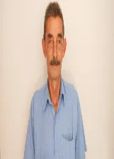 Nicanor