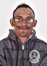 CHARLES HIPERSAÚDE
