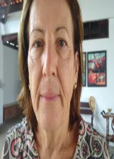 JACILENE