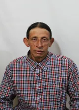 ALEX COELHO