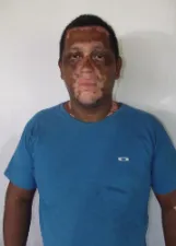 MARCIO