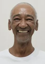 PELE DO AEROPORTO
