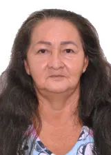 MÁTULA ACS