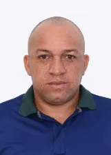 XIBAS