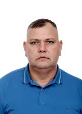BEIÇO DO ESPETINHO