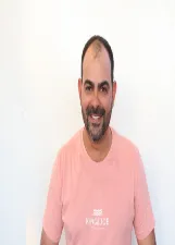 Gilson do Corrego Fundo