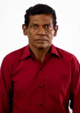 Tibias