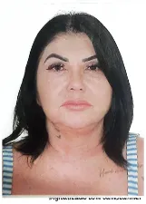 Gilma Amorim